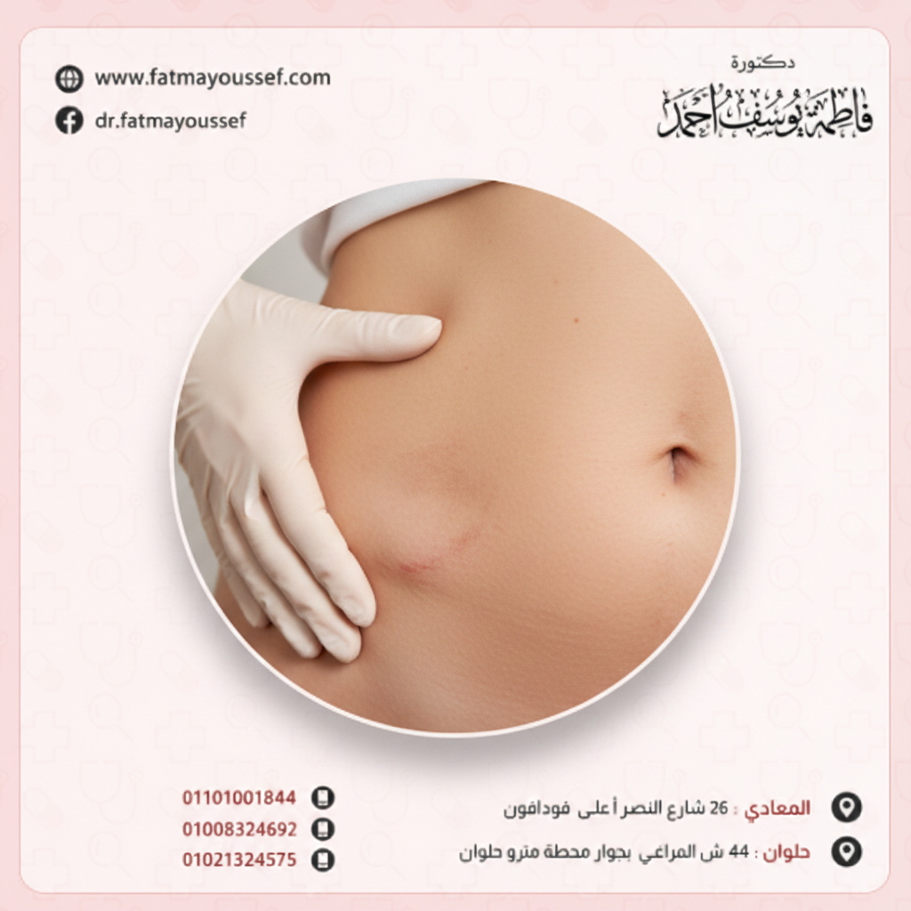 ماهي اضرار شفط الدهون – Problem