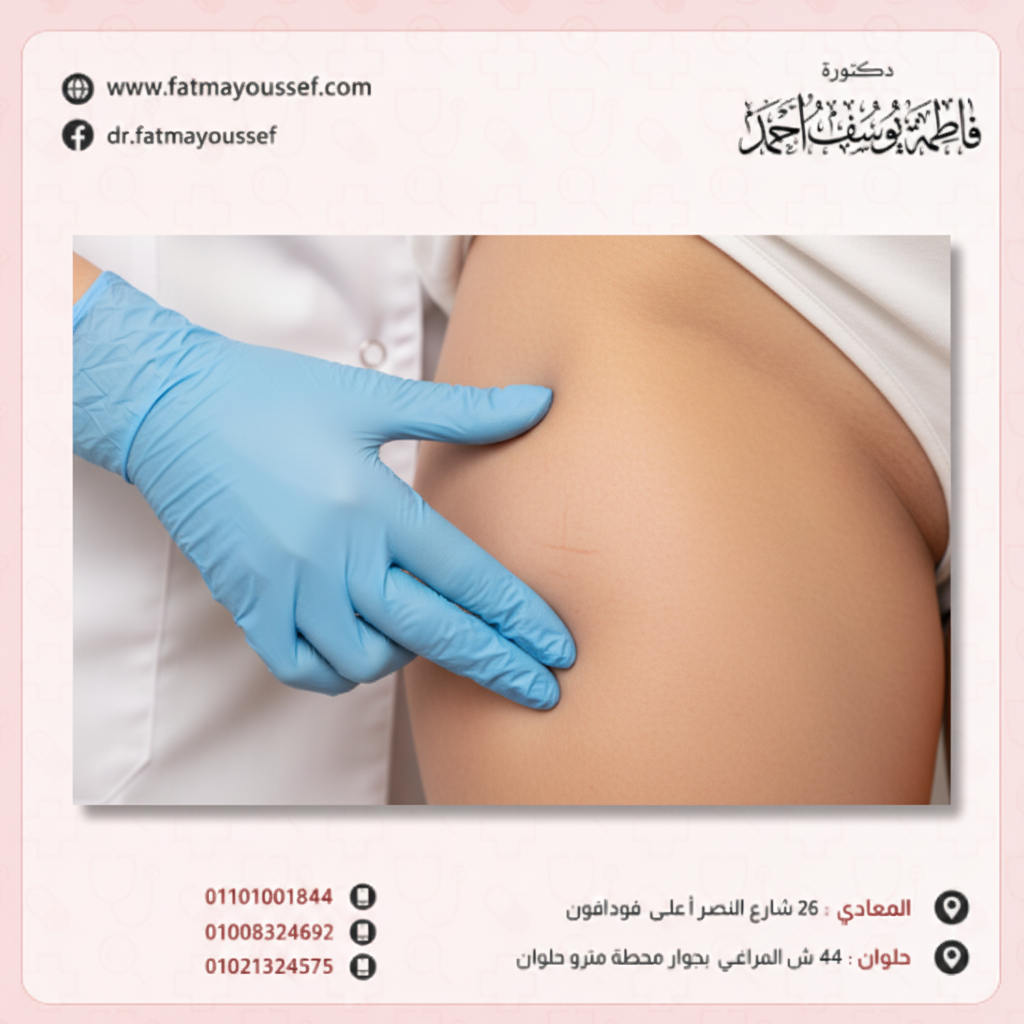 ترهل الافخاذ الامامية – Problem